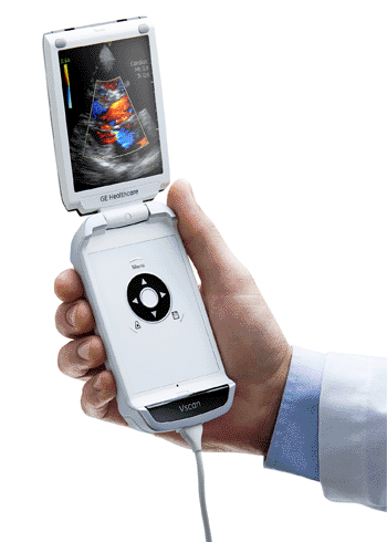 Image: The Vscan pocket-sized ultrasound visualization tool (Photo courtesy of GE Healthcare).